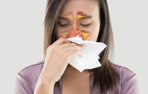 Allergic Rhinitis Symptoms and Home Remedies1